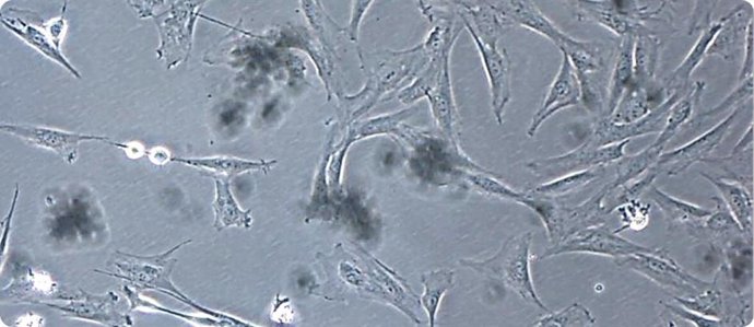 Células madre aBM-MSC