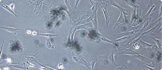 Células madre aBM-MSC