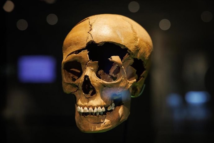 Archivo - Cráneo en el Museo de la Batalla de Varus en Kalkriese (Alemania).     