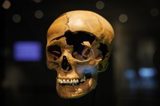 Archivo - 08 June 2023, Lower Saxony, Bramsche: View of the skull of a killed man. During excavations in 2018, the Varus Battle Museum in Kalkriese discovered a Roman splint armour, which the museum claims is the oldest and only one preserved worldwide. O