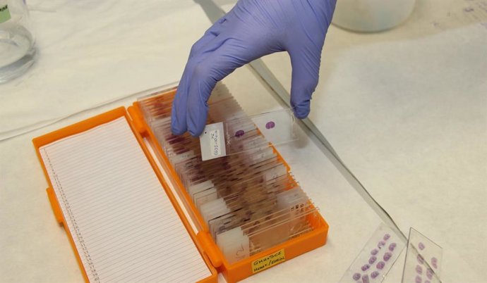 El Clínico San Carlos investiga un medicamento para el daño cerebral por falta de oxígeno en recién nacidos