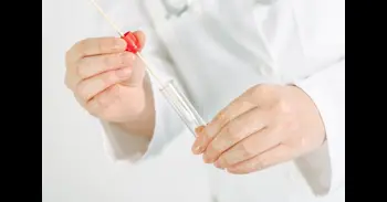 Un análisis de la saliva y las heces permite detectar precozmente el cáncer de estómago gracias a firmas bacterianas