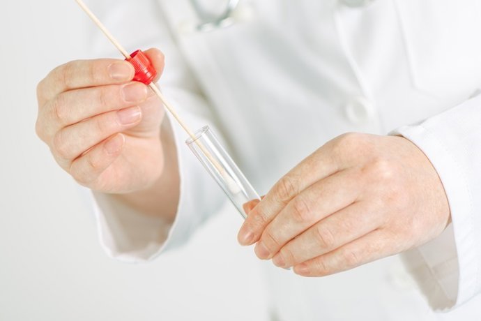Archivo - Female gynecologist holding disposable cervical sample swab