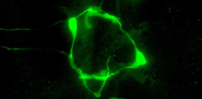 Marca de serotonina en las neuronas VC del nematodo C. Elegans modificado genéticamente./
