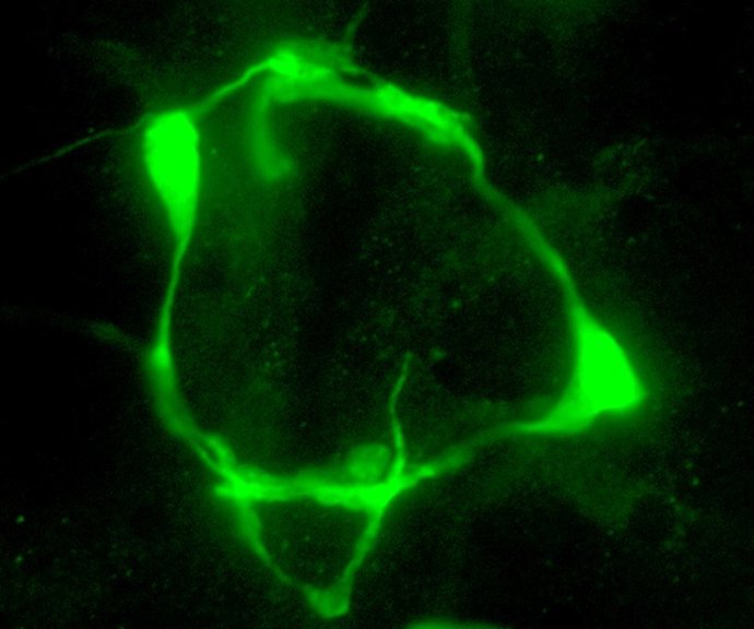 Marca de serotonina en las neuronas VC del nematodo 'C. Elegans' modificado genéticamente.