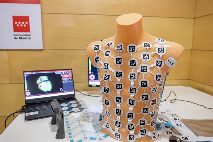Archivo - El Hospital Gregorio Marañón impulsa la llegada a Estados Unidos de su pionero sistema de mapeo cardíaco tras la aprobación de la FDA.