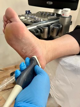 Un estudio refuerza el valor de la ecografía para mejorar el diagnóstico de la fascitis plantar