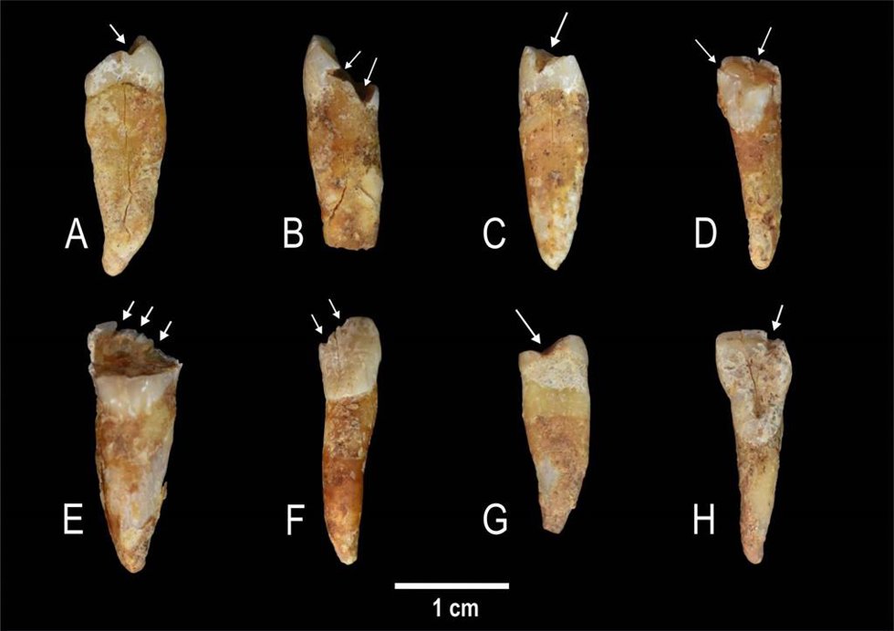 Dientes prehistóricos.