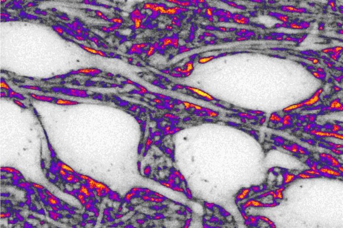 Imagem de neurônios em branco e do espaço extracelular em cores.