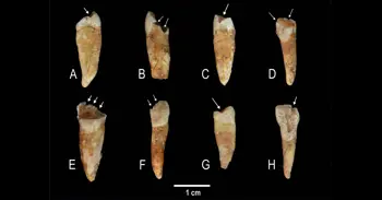 Marcas en los dientes revelan cómo se construían las identidades de género en la Prehistoria