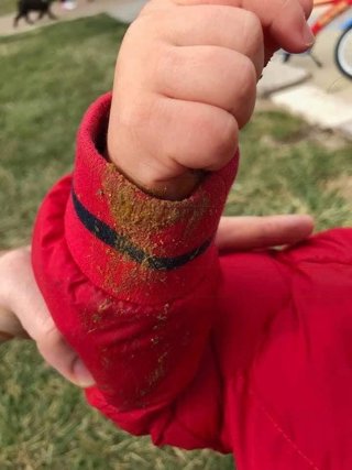 Consecuencia de excrementos caninos.