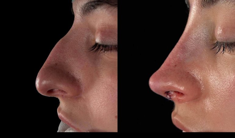 Comunicados Empresas