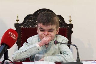 Archivo - El pequeño Leo, con la enfermedad ‘pie de mariposa’, interviene en la jornada 'Enfermedades raras: visibilidad para avanzar en la edad pediátrica'. A 18 de marzo del 2026 en Sevilla. Andalucía.  Leo, un niño sevillano de 12 años, logró que la Ju