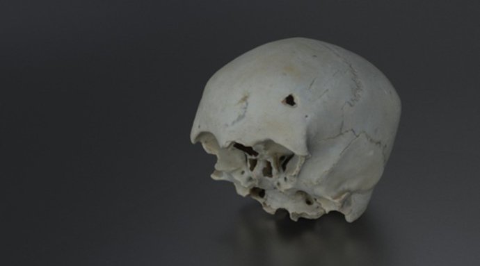 Cráneo humano hallado en el pecio 'Delta II', hundido en aguas de Cádiz en el siglo XVI