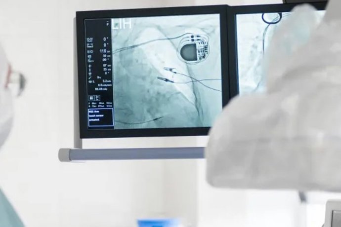 Imagen de archivo de un dispositivo médico.