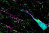 Foto: Descubren un "interruptor molecular" que guía el movimiento neuronal en la formación del cerebro