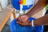 Foto: Los casos de cólera en el mundo descendieron en marzo un 56% con respecto al mismo mes de 2025