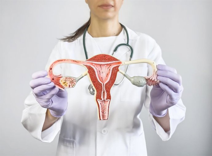 Archivo - Tratar el cáncer de ovario en unidad multidisciplinar "con alta experiencia", clave en este tumor de baja supervivencia