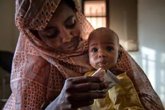 Foto: UNICEF destaca el éxito del alimento terapéutico listo para usar, con tasas de recuperación cercanas al 90%