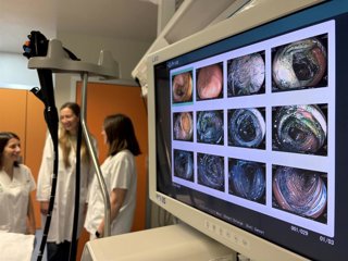Detección precoz de lesiones digestivas mediante cromoendoscopia.
