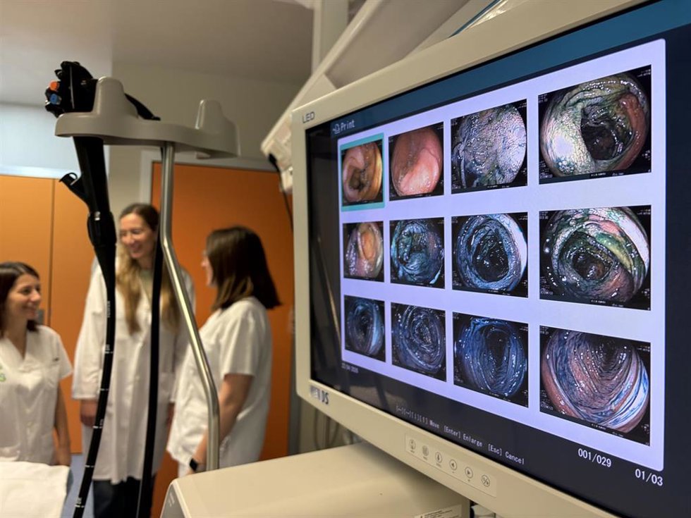 Detección precoz de lesiones digestivas mediante cromoendoscopia.
