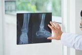 Foto: La Asociación AHUCE y su fundación exigen mejoras urgentes en la atención e investigación de la osteogénesis imperfecta