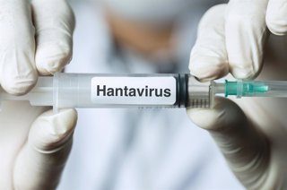 Archivo - Hantavirus.
