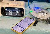 Foto: Empresas.- Fundación Jiménez Díaz implementa un dispositivo que controla y personaliza la oxigenoterapia en tiempo real