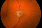 Foto: Descubren un 'equipo de limpieza' en el ojo que podría ayudar a prevenir la ceguera