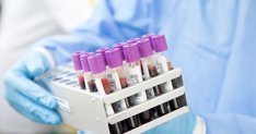 Investigación