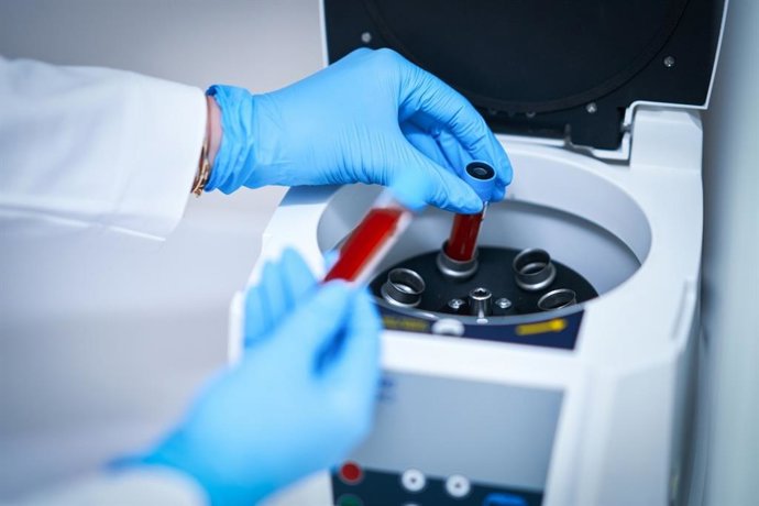 Archivo - El método estudiado por los expertos solo requiere una extracción de sangre. El análisis de la muestra se realiza con equipamiento presente en muchos laboratorios hospitalarios.