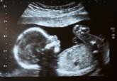 Foto: Cuando la presión arterial de la madre condiciona el corazón del hijo