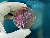 Foto: El ECDC advierte sobre la creciente propagación de 'Shigella' multirresistente en Europa y EEUU
