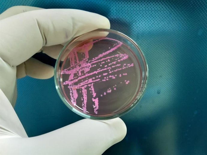 Archivo - Cultivo y prueba sensible en medio de agar Salmonella Shigella