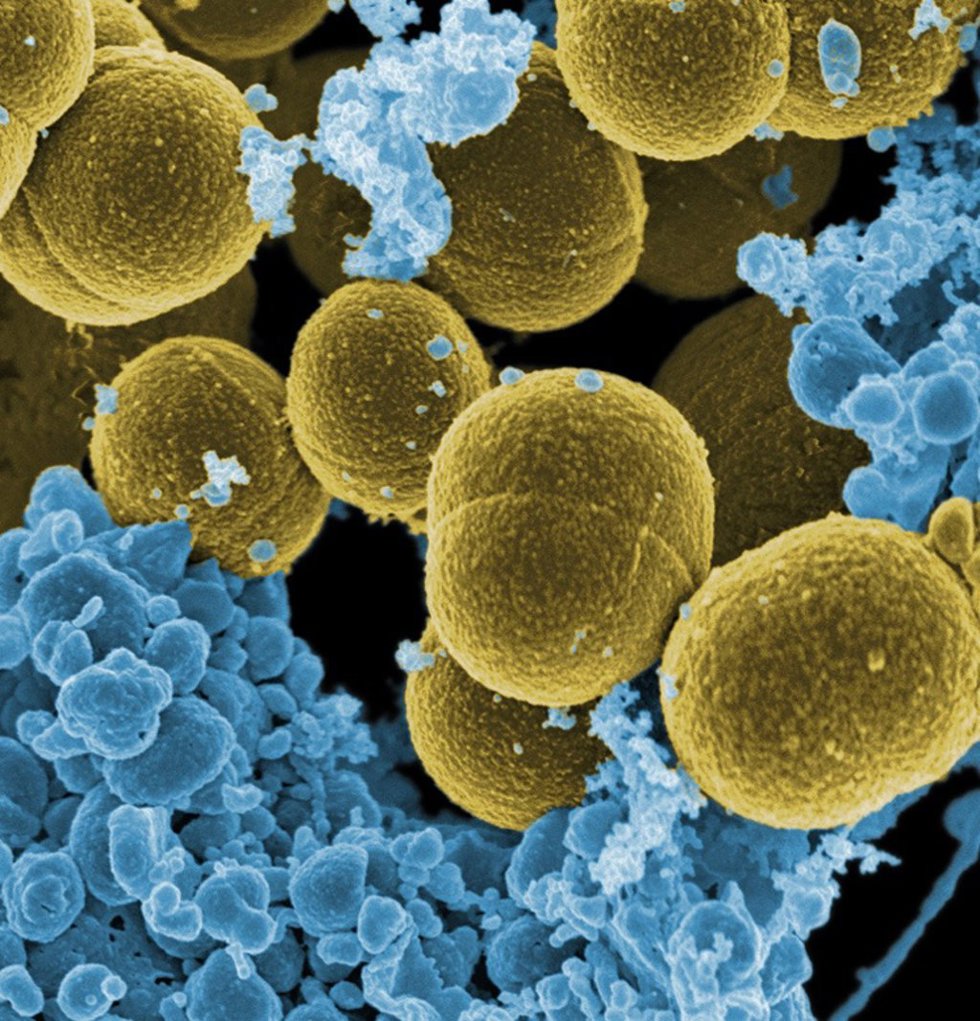 Staphylococcus aureau