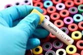 Foto: Las ITS bacterianas alcanzan "niveles récord" en Europa en 2024, con 106.000 casos de gonorrea y 45.500 de sífilis