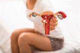 Foto: La mitad de las mujeres con endometriosis esperan más de cuatro años para recibir un diagnóstico