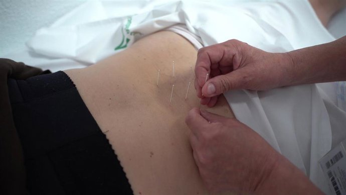Aplican acupuntura a un paciente en el Hospital Virgen de las Nieves de Granada.