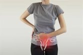 Foto: El test del VPH, la herramienta más eficaz para detectar el cáncer de cérvix