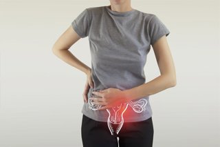 Archivo - Cáncer de cérvix.