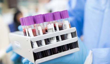 Investigación
