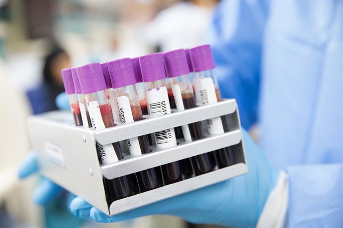 Archivo - Imagen de recurso de tubos con sangre para su análisis.