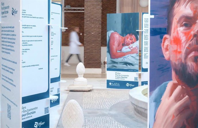 Muestra sobre la dermatitis en el Hospital Virgen del Rocío de Sevilla