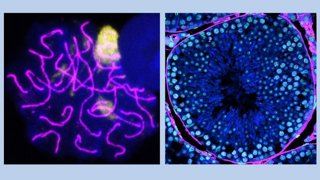 Espermatocito (izquierda) y túbulo seminífero de ratón (derecha) visualizados por microscopia de alta resolución.