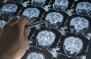 Archivo - IQS estudia el mecanismo de influencia de la diabetes en el deterioro cognitivo y el desarrollo del Alzheimer