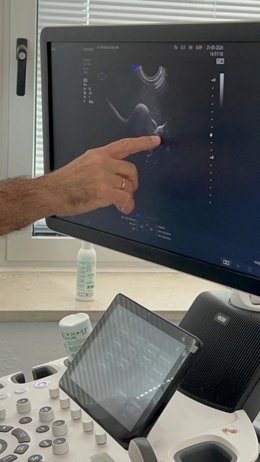Regional de Málaga forma a profesionales en una técnica avanzada para el estudio de infertilidad