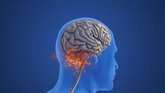 Foto: Un compuesto natural obtiene resultados prometedores en ataxia de Friedreich, una enfermedad neurodegenerativa rara