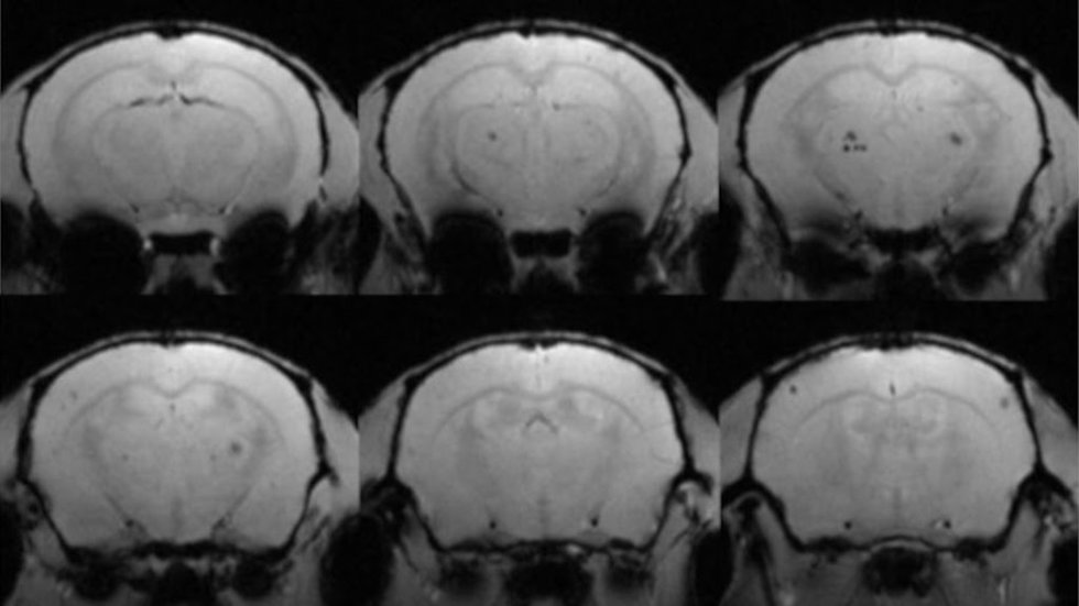 Seis secciones de cerebros de ratón con microhemorragias