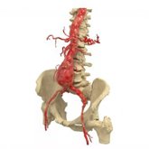 Foto: Ivace+i financia una herramienta asistida por IA para anticipar el riesgo de rotura de aneurismas de aorta abdominal