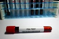 Urólogos destacan que la anticipación es la "mejor herramienta" frente al cáncer de próstata